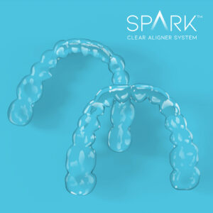 Spark clear aligners are shown