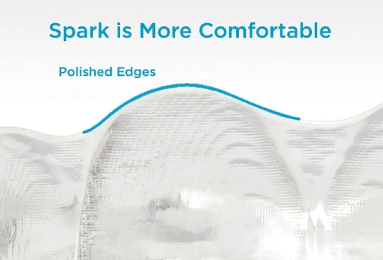 More Comfortable Due to Polished Edges on Spark Aligners
