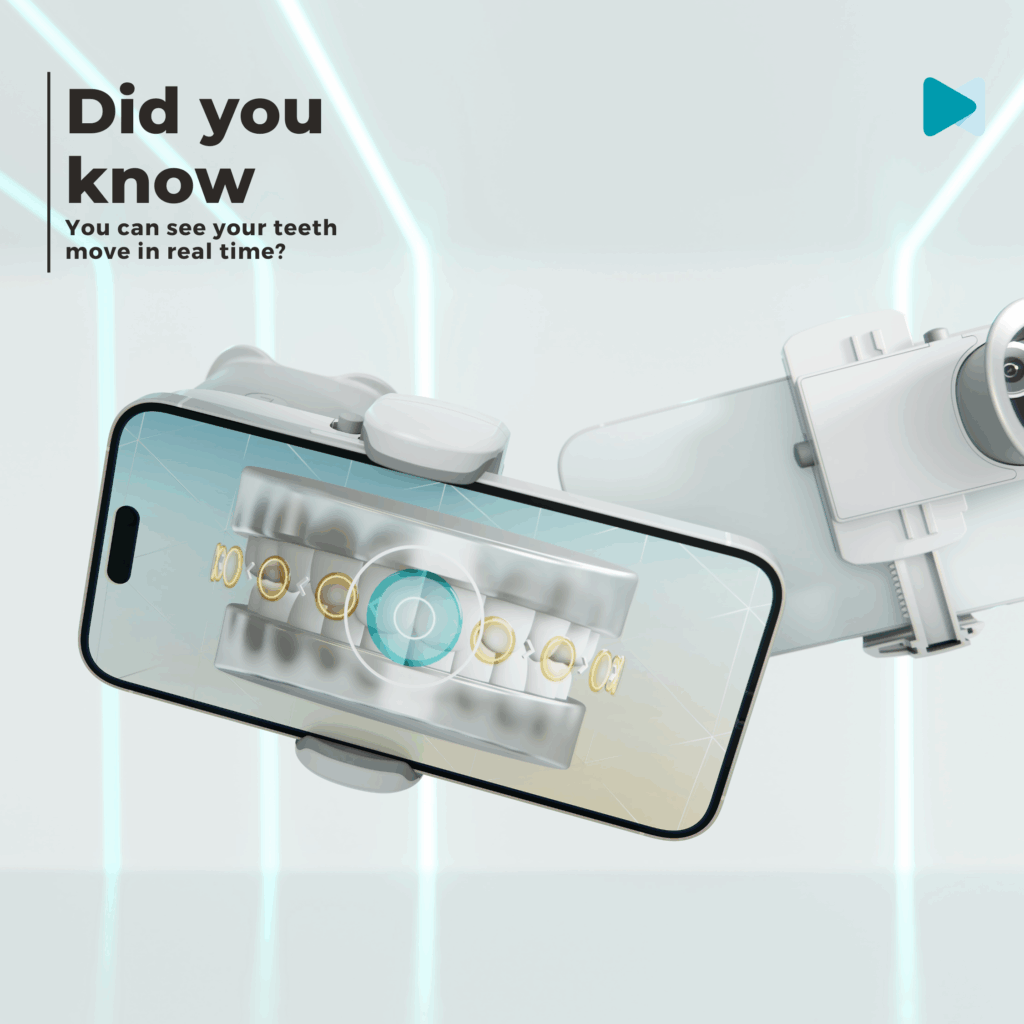 A dental monitoring scanbox is shown with text saying "Did you know? You can see your teeth in real time?"
